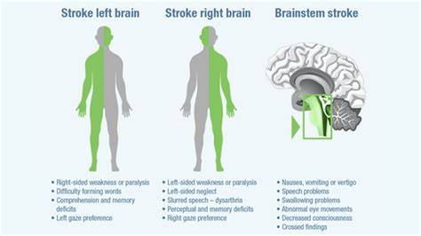 Kelemahan Sebelah Badan Stroke