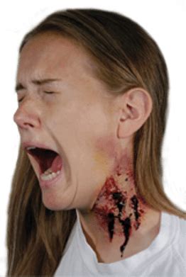 Werewolf bite infection