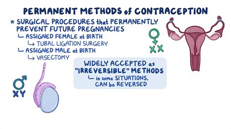 What are 3 methods for permanent methods of birth control