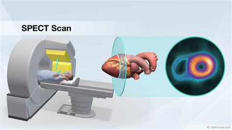 What can a SPECT scan show