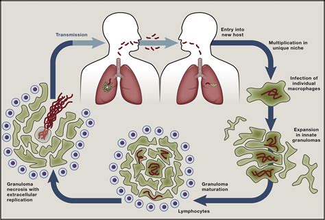 What can kill Mycobacterium tuberculosis