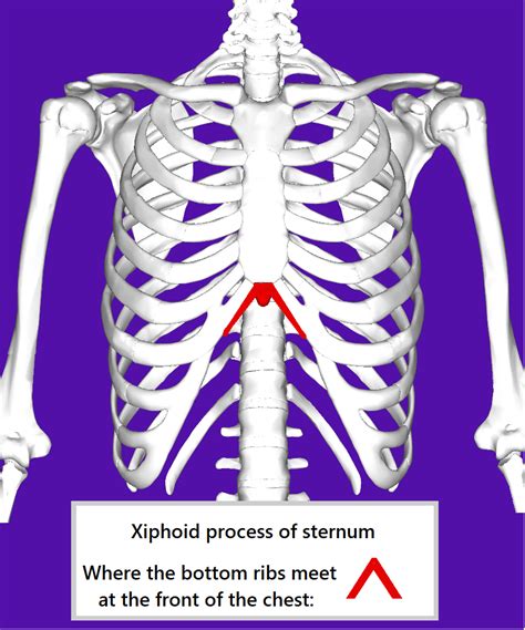 What causes a protruding xiphoid process