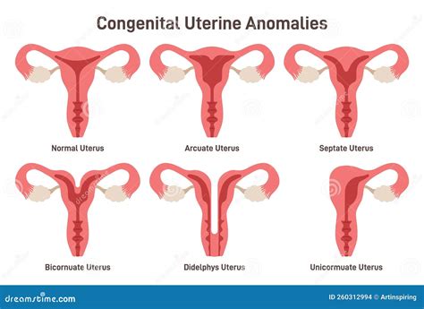 What causes abnormalities in the uterus