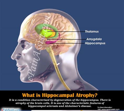 What causes atrophy of the hippocampus