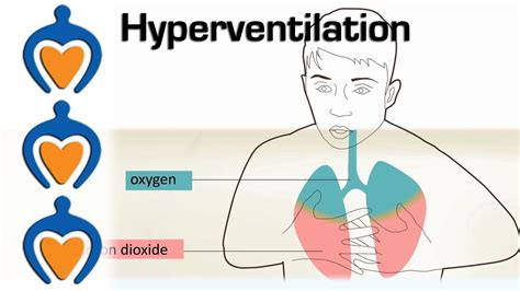 What causes hyperventilation