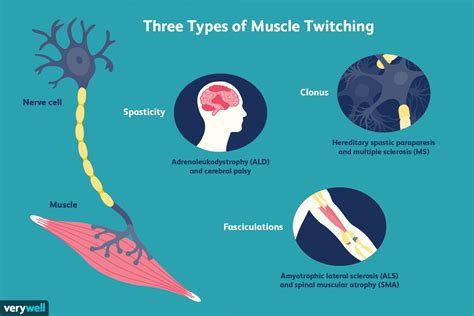 What causes muscles to twitch
