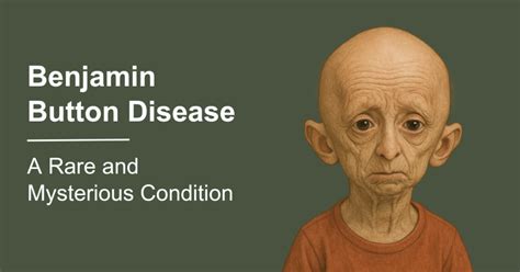 What disease does Benjamin Button have