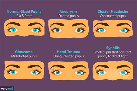 What do pupil changes mean