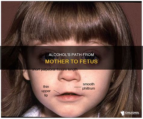 What does alcohol do to a fetus