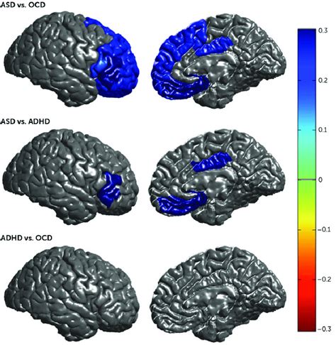 What does having a thicker cortex mean