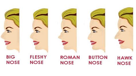 What does it mean if you have a Roman nose