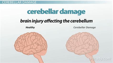 What happens if you damage the cerebral cortex