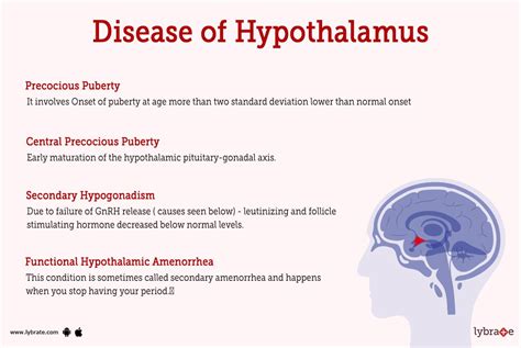 What happens if you have a stroke in the hypothalamus