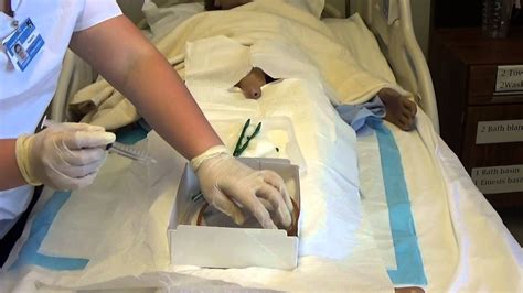What happens when a man gets sterilized