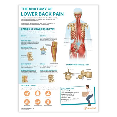 Apa Itu Low Back Pain