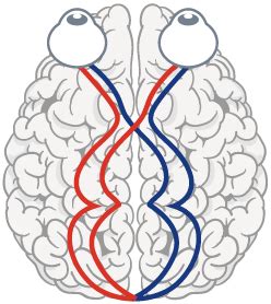 What is Streff Syndrome