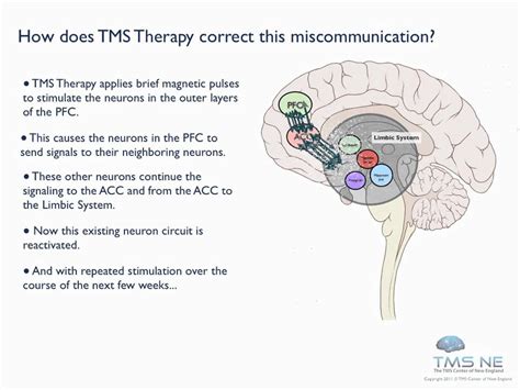 What is TMS therapy and does it work