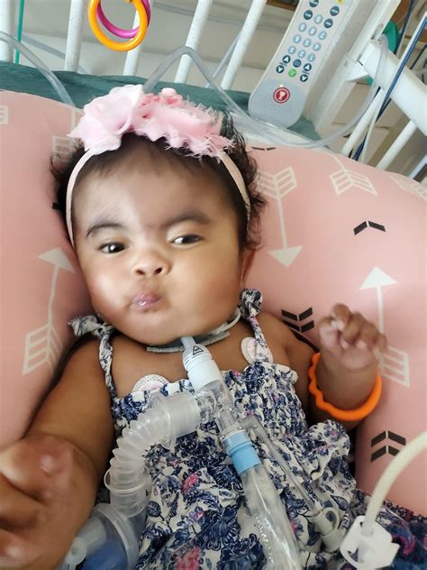 What is a miracle baby