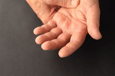 What is a neurogenic tremor