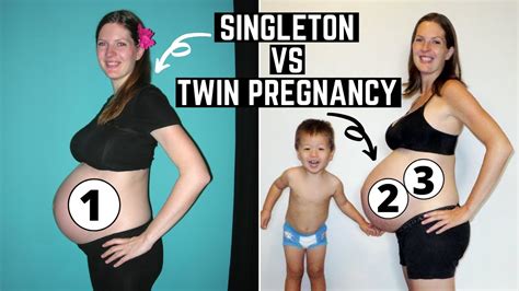 What is a singleton baby