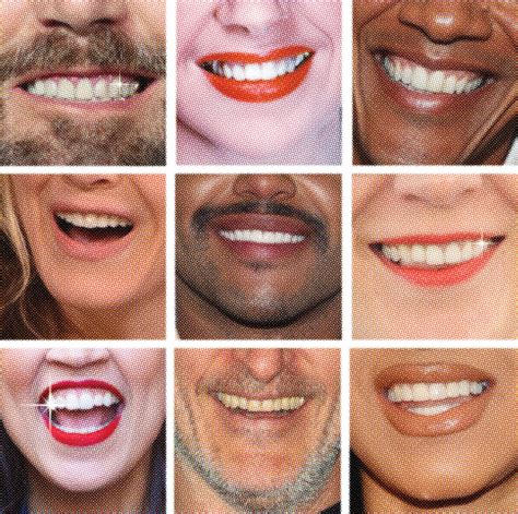 What is an American smile