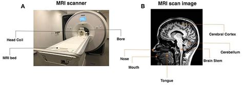 What is an MRI in psychology