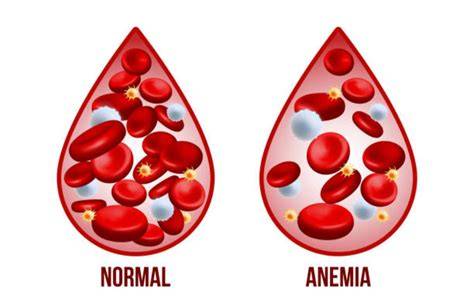What is anemia