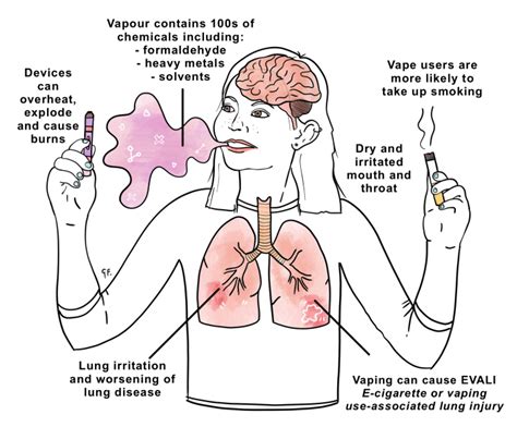 What is causing the vape sickness