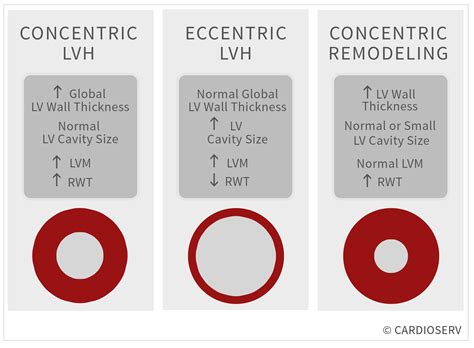 What is concentric LVH in heart