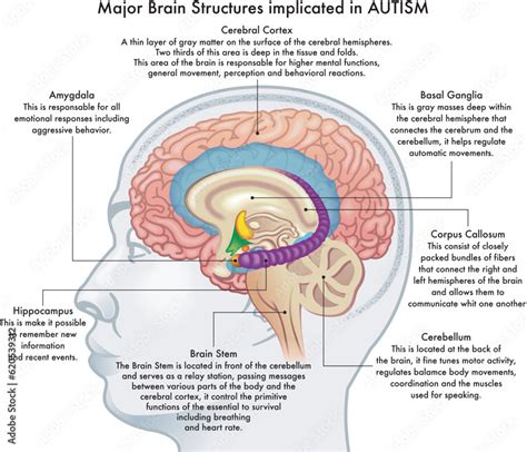 What is different about an autistic brain