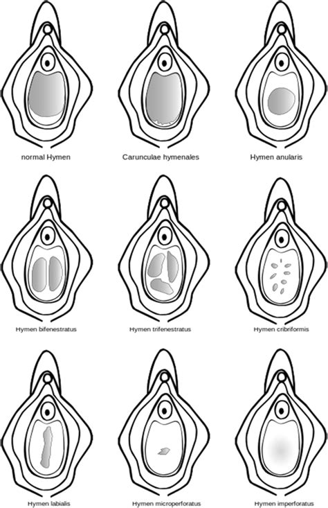 What is hymen