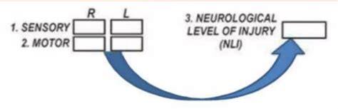 What is neurological level