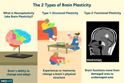 What is neuroplasticity in the brain