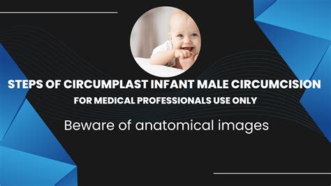What is routine infant circumcision
