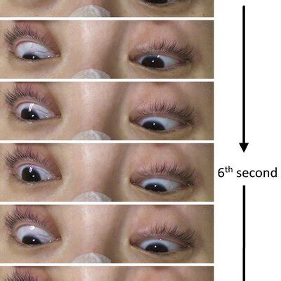 What is slow eye movement