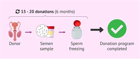 What is sperm donation procedure
