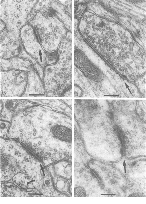 What is synaptic overproduction