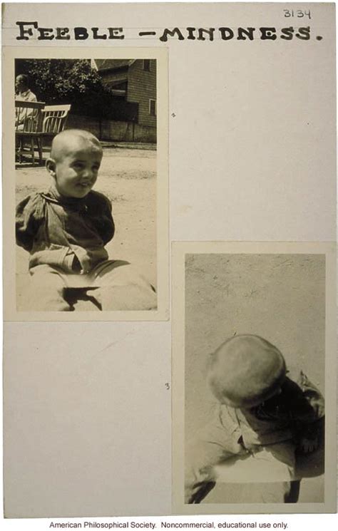 What is the definition of feeble minded