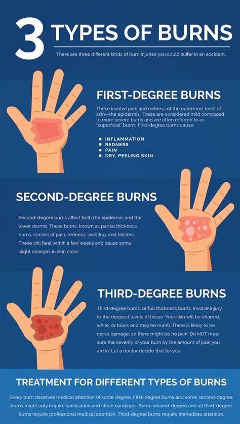 What is the difference between 1st 2nd and 3rd degree burns