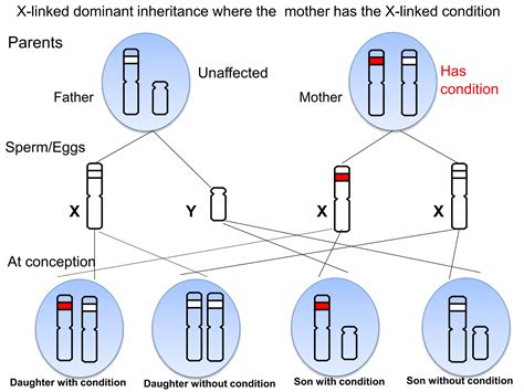 What is the most common X linked condition