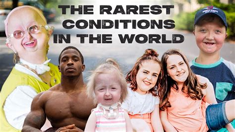 What is the rarest condition in the world