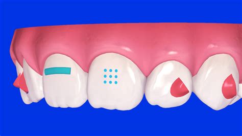 What is the root of control