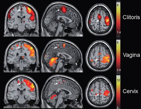 What part of the brain is most active during orgasm