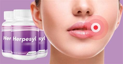 What supplements are good for herpes