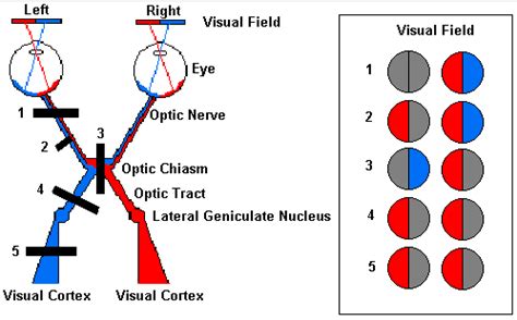 What would happen if the primary visual cortex is damaged
