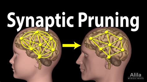 Where does pruning occur in the brain
