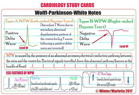 White Arrhythmia