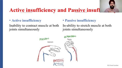 active and passive insufficiency explained