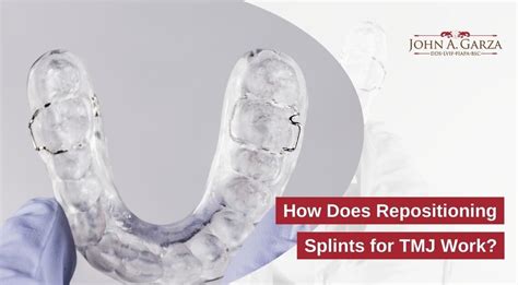 ada code for trauma splint