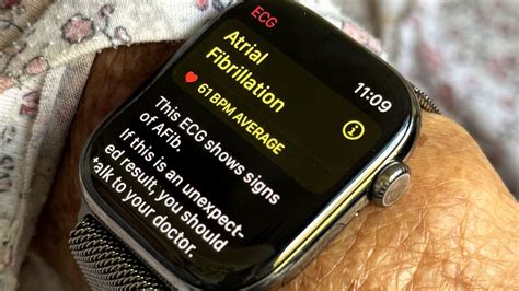 apple watch ecg detect afib